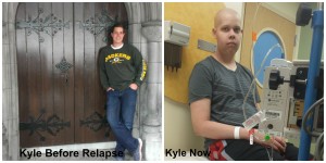 kyle cancer before and after